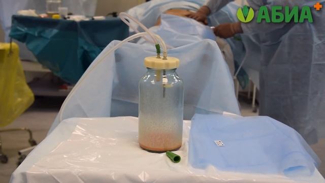 Утолщение полового члена (липофилинг) смотреть онлайн