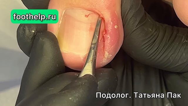 Спровоцировала длина ногтя. смотреть онлайн