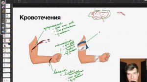 6.58. Виды кровотечений. Первая помощь при кровотечениях. _ Анатомия к ЕГЭ _ Георгий Мишуровский