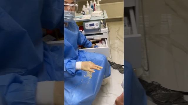 Окаменевшая кожа на пятках | результат до и после | #подологтатьянапак смотреть онлайн