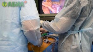 Шунтирование желудка (гастрошунтирование)