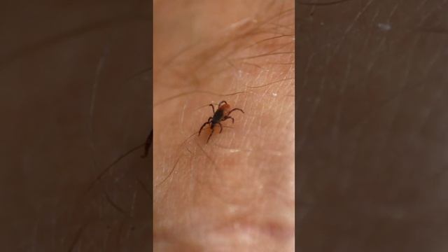 The Tick Walks On The Human Body
