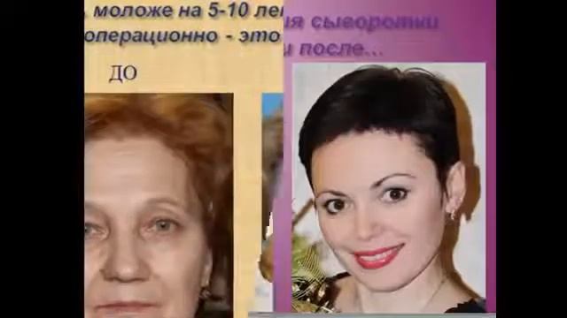 Омоложение! Сыворотка Ageless работает!!! смотреть онлайн