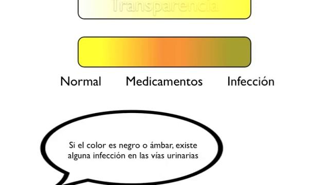 pH de soluciones y examen general de orina смотреть онлайн