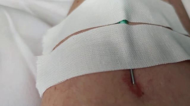 Капельница смотреть онлайн