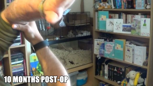 Skin Graft Healing Over 4 Years & Tattoo Scar Covering (After Phalloplasty Surgery) смотреть онлайн