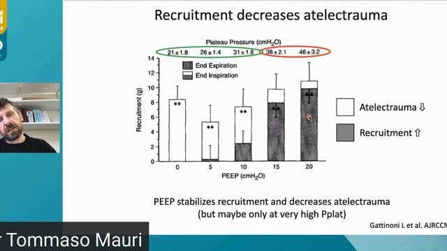 Routine recruitment T  Mauri  (isicem ARDS 2021)