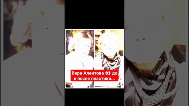 Вера Алентова до и после пластики...#shorts #short #алентова смотреть онлайн