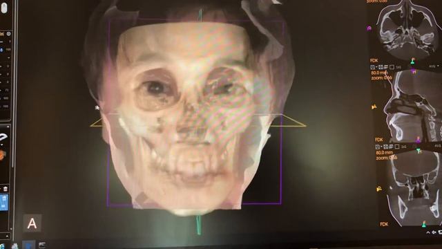 フェイススキャンデータの重ね合わせ смотреть онлайн