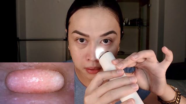 Blackhead Remover With Camera