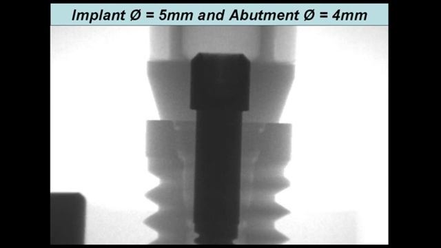 Zipprich Micro Movements on Implant Abutment Interfaces part 1 смотреть онлайн