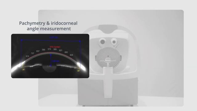 VX650 multi modal eye screening device смотреть онлайн