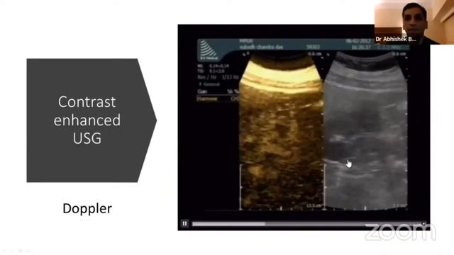 Dr Abhishek Bansal | Ideal Investigation Pathway for Renal Cell Carcinoma смотреть онлайн