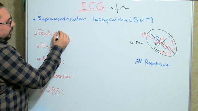supraventricular tachycardia SVT ( English ) ECG смотреть онлайн
