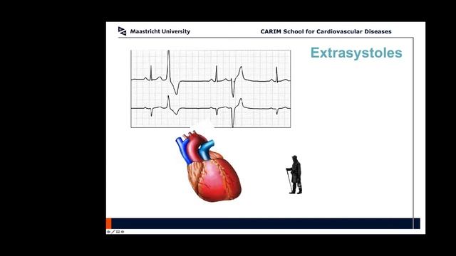 Webinar 9 - ECG, Cardiac Devices: Pacemakers смотреть онлайн