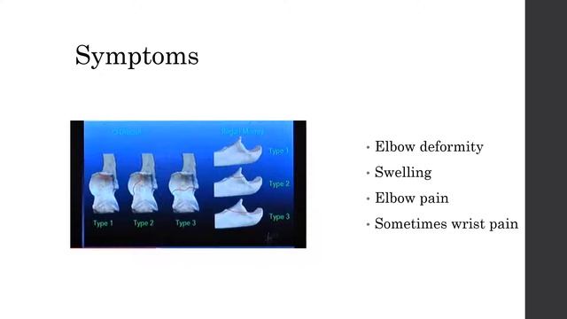 Coronoid Fracture- Alexis Jenkins смотреть онлайн