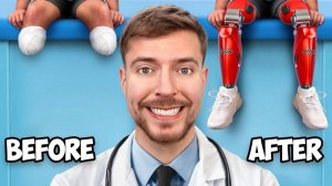 MrBeast Я Помог 2000 Людям Снова Ходить