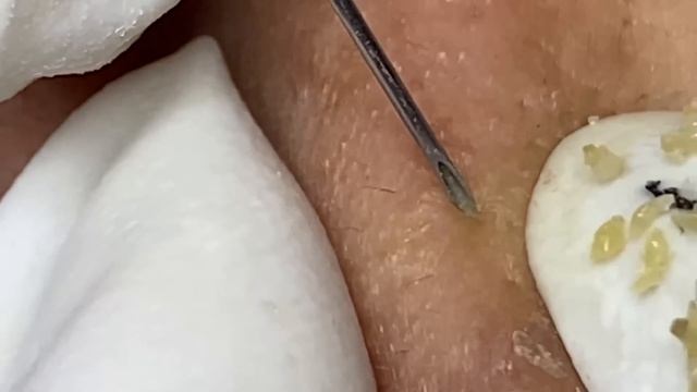 Enjoy Every Day With The Best Video Loan Nguyen Spa Official  2636