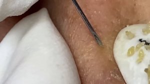 Enjoy Every Day With The Best Video Loan Nguyen Spa Official  2636