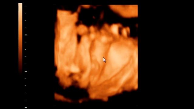 3D-узи 27-28 недель смотреть онлайн