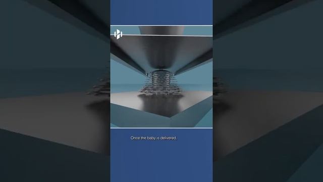 Методика родовспоможения, патент 60-х годов. смотреть онлайн