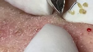 Enjoy Every Day With The Best Video Loan Nguyen Spa Official  2411