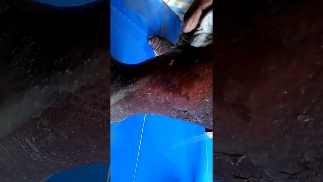 Elephantiasis reaction смотреть онлайн