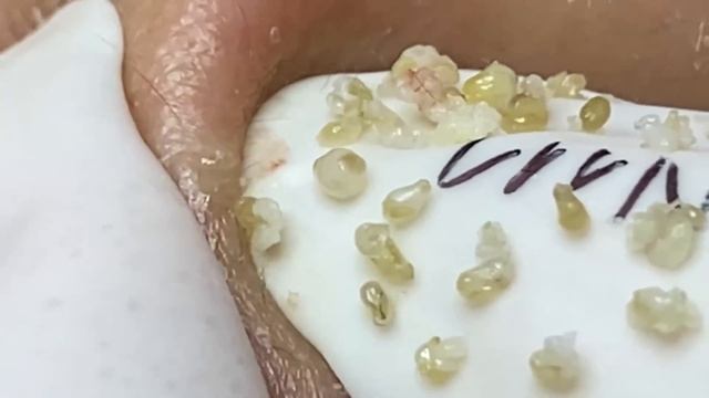 Enjoy Every Day With The Best Video Loan Nguyen Spa Official  2419