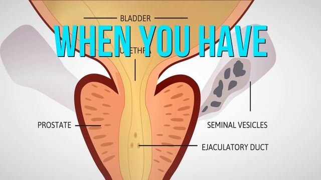 Best Prostate Health Product 2021 смотреть онлайн