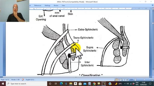 Anal Disorders in Arabic 7 (Anal Fistula , parts 1) , by Dr. Wahdan смотреть онлайн
