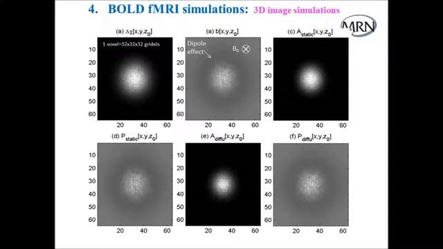 Zikuan Chen Ph.D. - Mind Research Network lecture смотреть онлайн