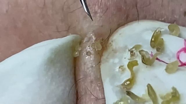 Enjoy Every Day With The Best Video Loan Nguyen Spa Official  2481