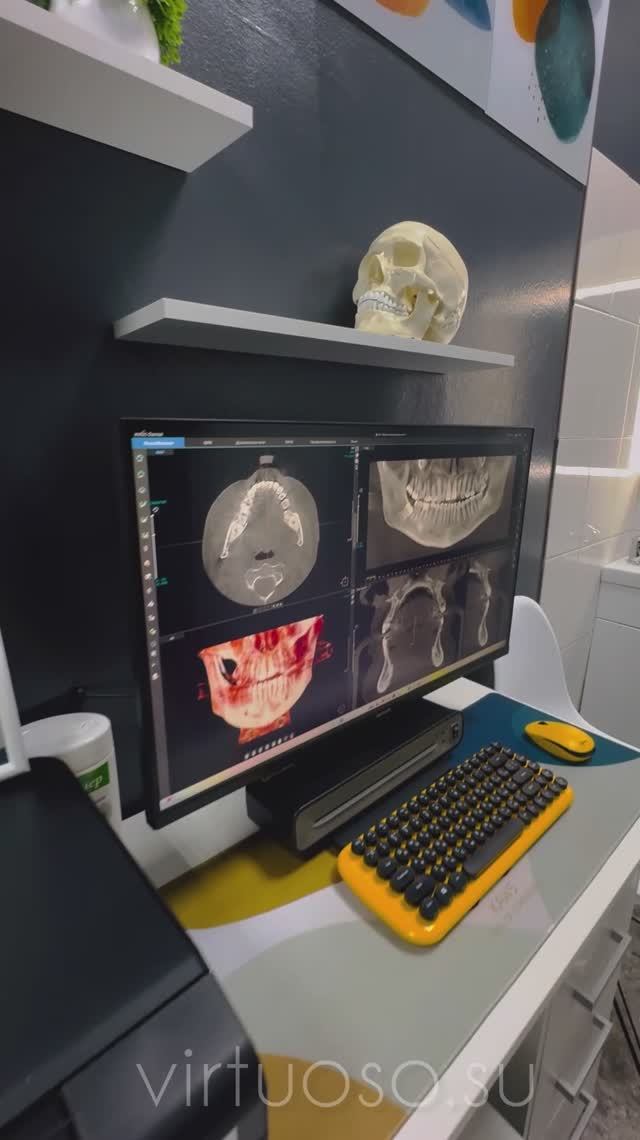 Конусно-лучевая компьютерная томография (КЛКТ)