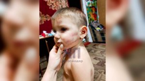 Соседи рассказали о семье избитого трехлетнего ребенка в Тимашевском районе