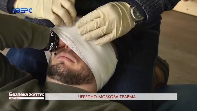 БЕЗПЕКА ЖИТТЯ. Черепно-мозкова травма. (Олег Яковенко) смотреть онлайн