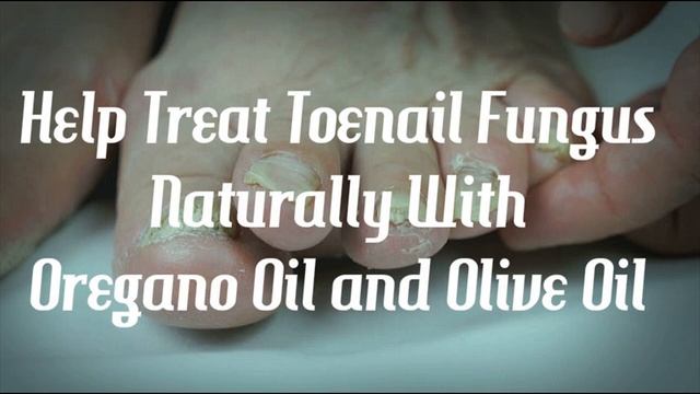 Are Oregano Oil and Olive Oil Effective Against Toenail Fungus? смотреть онлайн