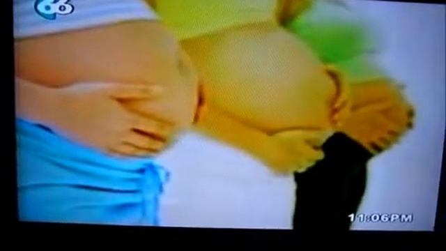 TRASPLANTE DR. CESAR GONZALEZ смотреть онлайн