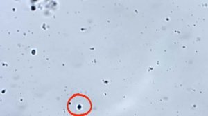 Покупная квашеная капуста под микроскопом.