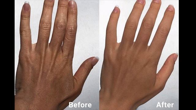 BEST Hand Cream For Aging Hands - Wrinkled, Cracked, Dry Hands REPAIRED! смотреть онлайн