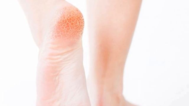 Oriflame Foot whitening cream| foot care Easiest and Effective Summer/ Winter|Oriflame Consultant смотреть онлайн