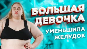 Резекция желудка в 22 года. Вес 155 кг. Бариатрическая хирургия. Хирургическое лечение ожирения.