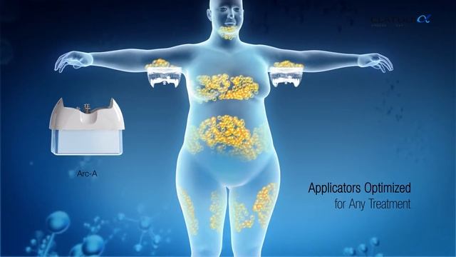 КРИОЛИПОЛИЗ НОВОГО ПОКОЛЕНИЯ НА СОВРЕМЕННОМ АППАРАТЕ CLATUU смотреть онлайн