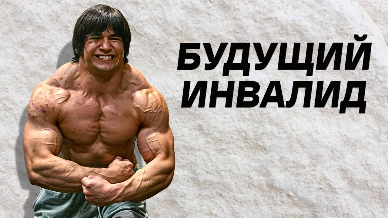 Фанат Сэма Сулека Гниёт На Химии с 15 и Рад Этому смотреть онлайн