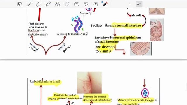Strongyloides stercoralis смотреть онлайн