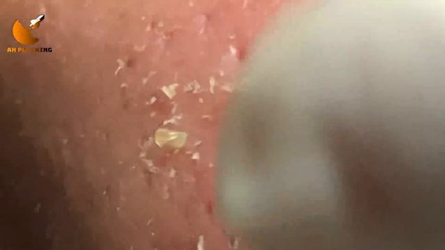 Satisfying Your Day With An Spa Plucking Videos #16