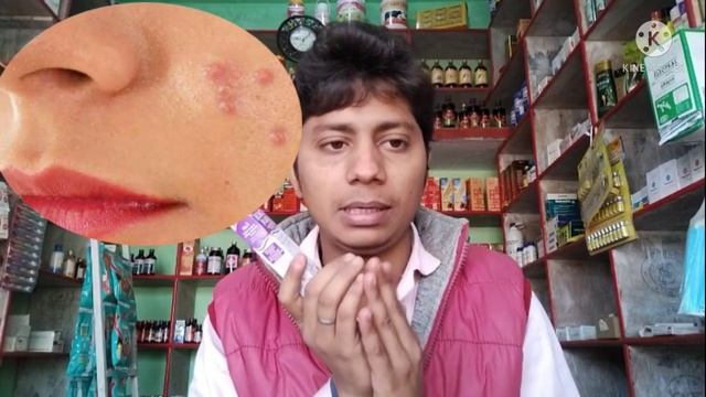 Boro plus cream ke fayde | boro plus cream in hindi | antiseptic cream | ayurvedic antiseptic cream смотреть онлайн