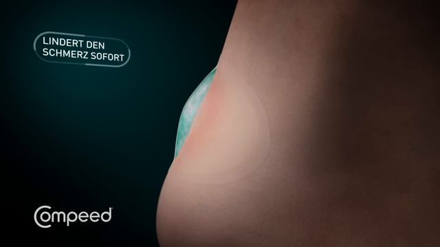 COMPEED® High Heel - sofortige Schmerzlinderung bei Blasen смотреть онлайн