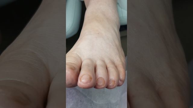 медицинский педикюр для пожилой женщины. смотреть онлайн