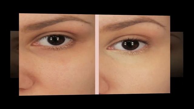 How to Use Baking Soda for Dark Circles? смотреть онлайн