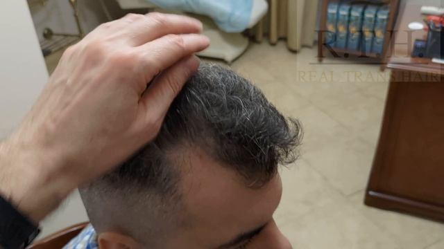 Зачем Павлу пересадка волос? смотреть онлайн